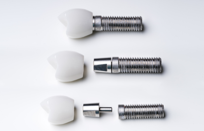 How to Get Dental Implants: A Detailed Guide - Dental Implants - 2