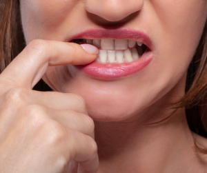 Are Teeth Aligners the Solution to Open Bites?