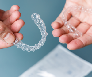 Clear Aligners: A New Alternative To Braces